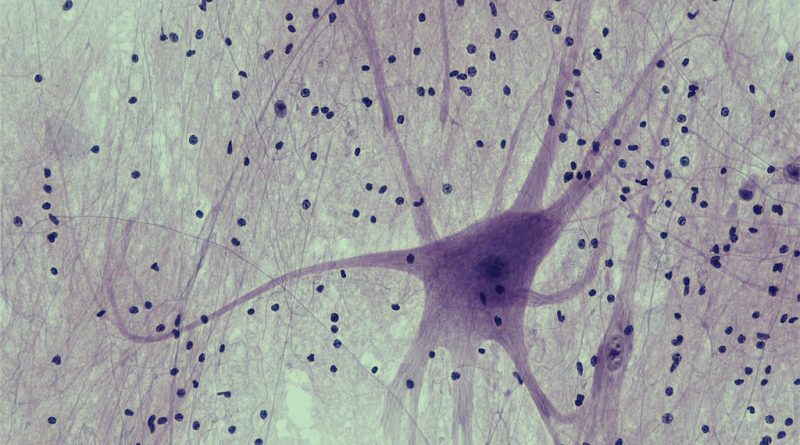 Neuroprotective effects of α-Lipoic acid alone and in combination with ferulic acid in diabetic neuropathy induced rats