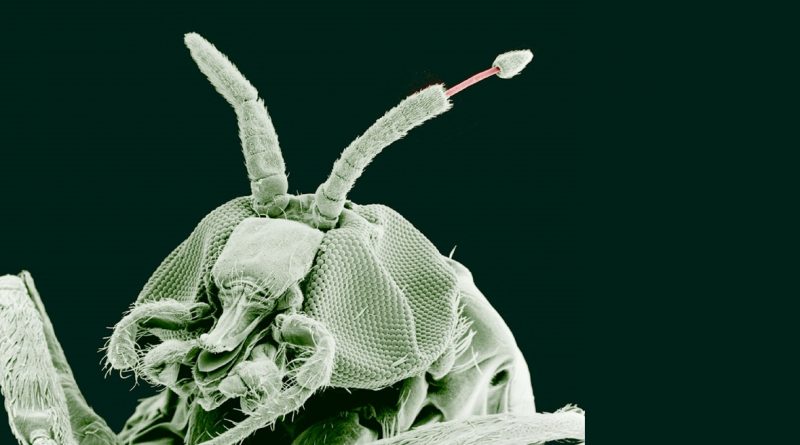 Possible recrudescence of onchocerciasis within Kaduna metropolis: microfilariae load and transmission potential posed by blackfly