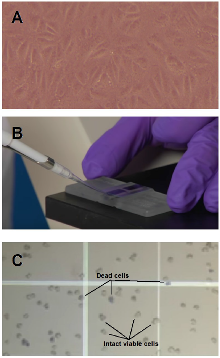 Comparative study on the viability of Vero cells stored under various levels of cryopreservation variables