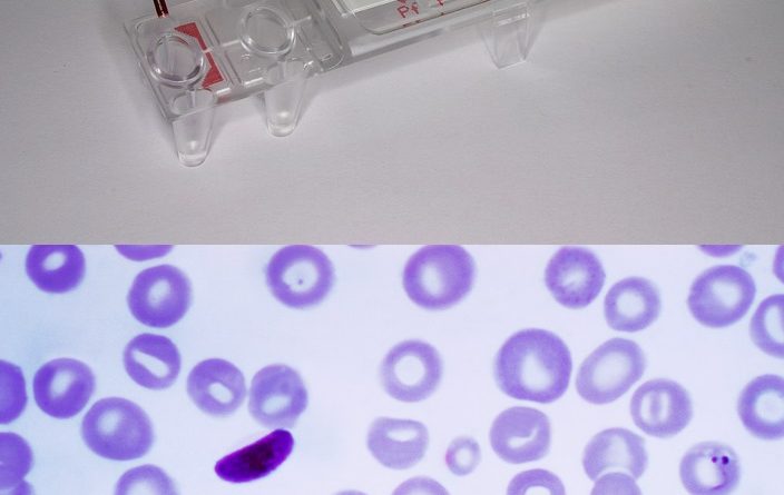 Determination of malaria rapid diagnostic test effectiveness compared to microscopy (Gold standard)